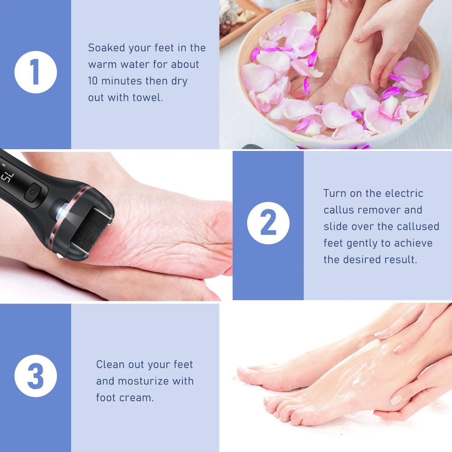 Electric Callus Remover for Soft Feet