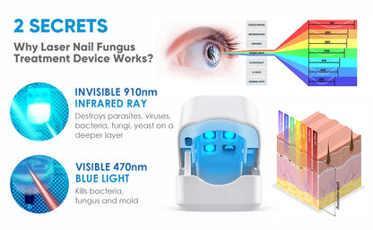 Nail Fungus Laser Treatment Device